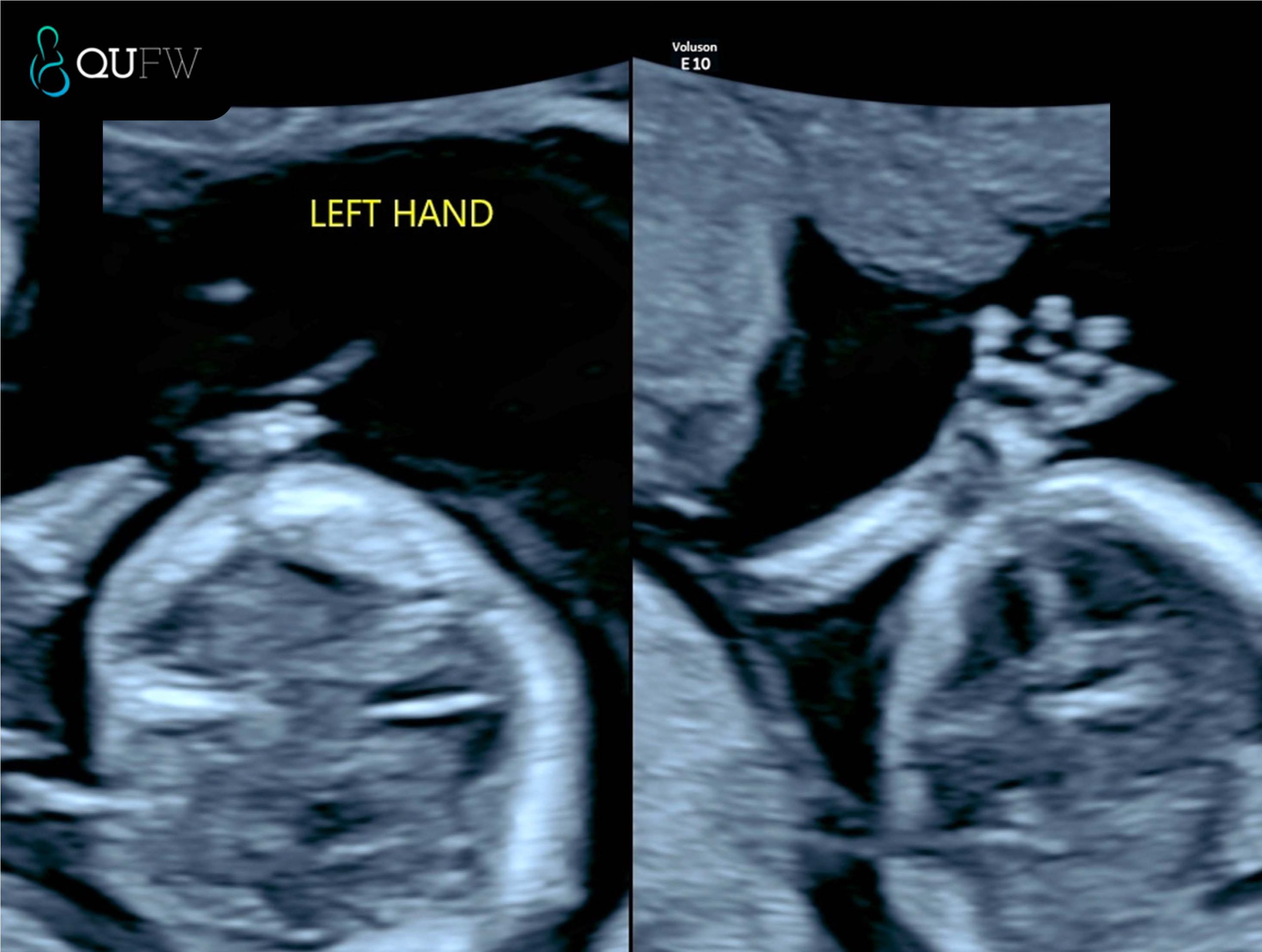 HANDS