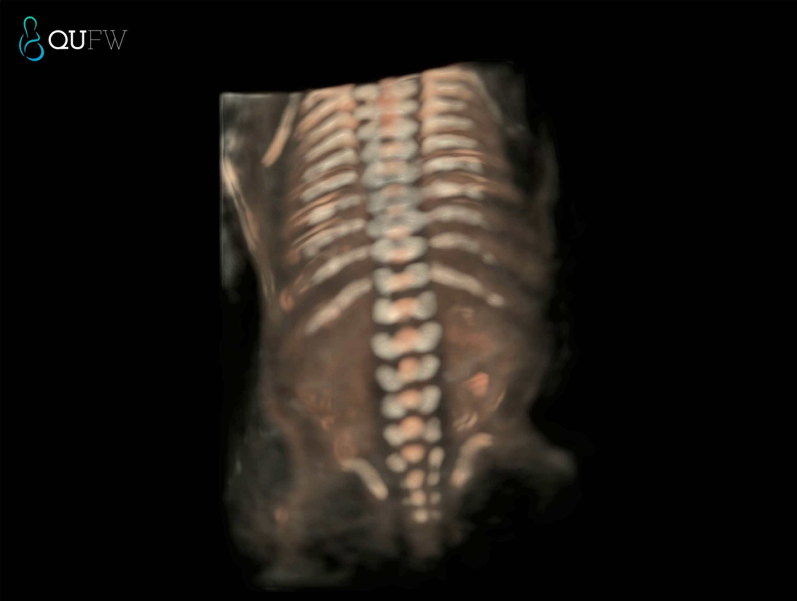 SPINE3D