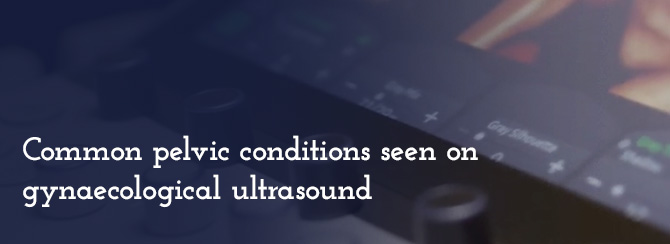 Common pelvic conditions seen on gynaecological ultrasound